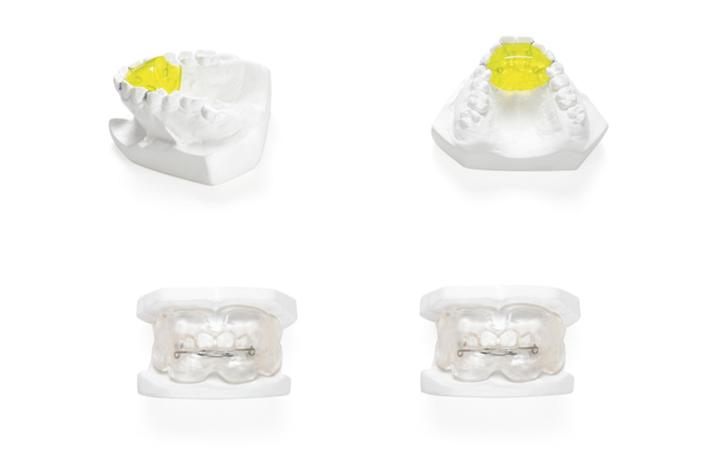 Inclined guide plate - Guangdong Crown Of Tooth Group Co., Ltd.